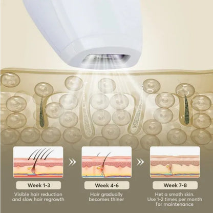 IPL Laser Hair Removal Device 900,000 Flashes for Body, Face & Bikini