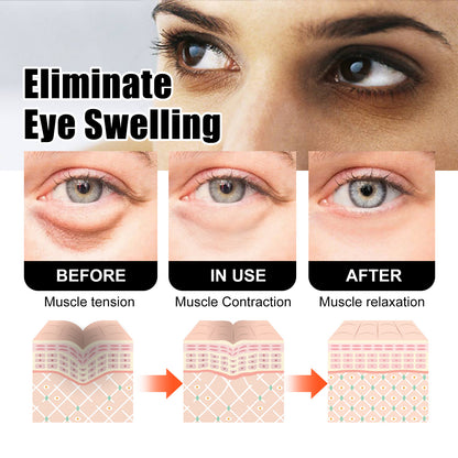 West&Month Snake Venom Peptide Eye Cream Gently Nourishes Skin, Reduces Fine Lines, Hydrates And Moisturizes Eye Cream